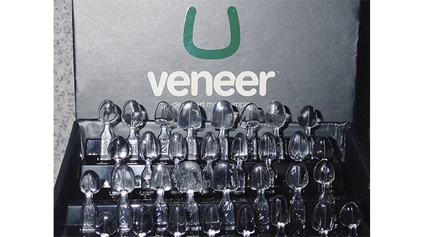 uveneer carillas composite ultradent ecuador (5)